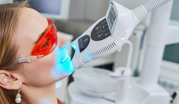 Отбеливание зубов: профи vs домашние методы