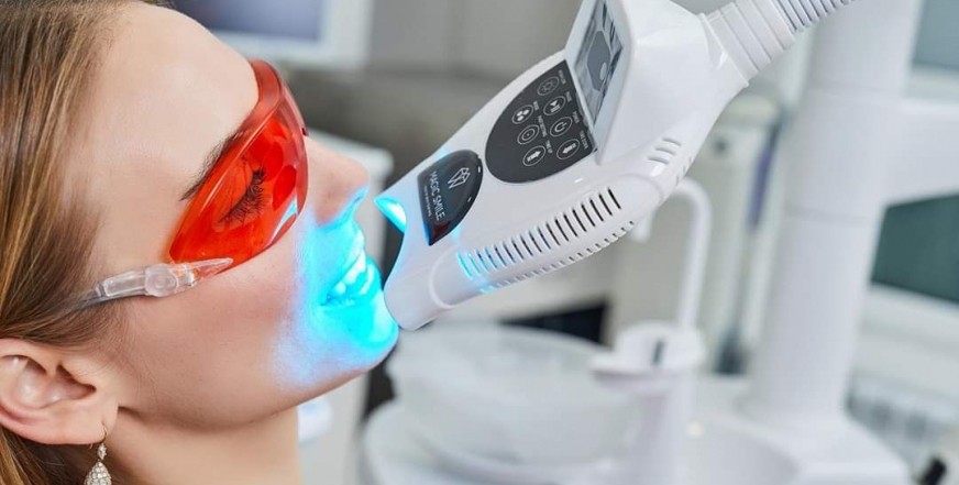 Отбеливание зубов: профи vs домашние методы